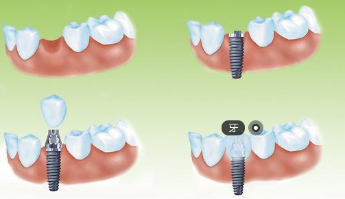 樹人論文發(fā)表網(wǎng)